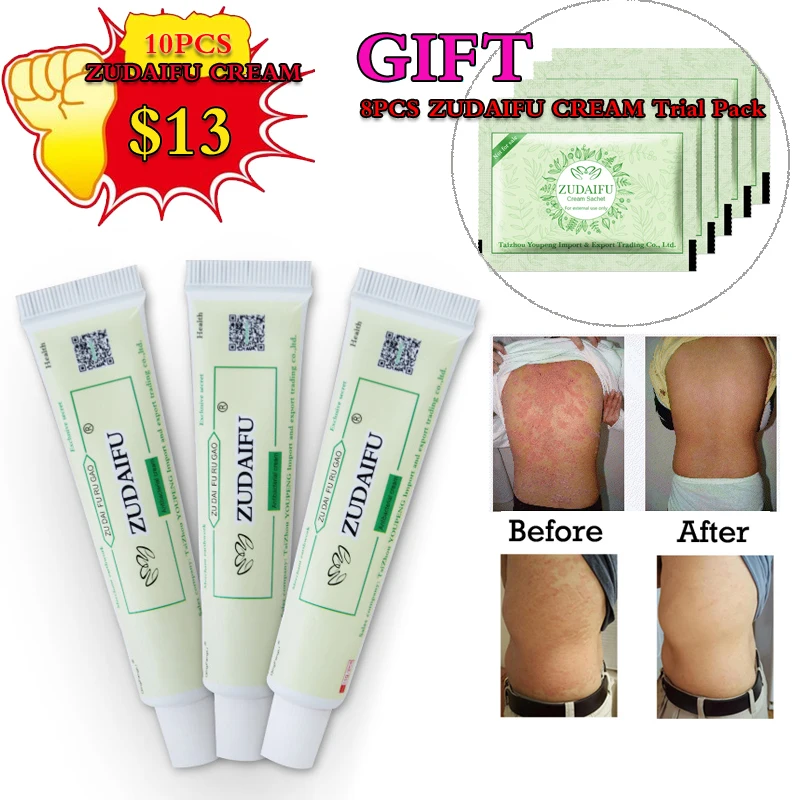 

10pcs ZUDAIFU Psoriasis Cream Dermatitis Eczematoid Eczema Ointment Treatment Psoriasis Balm for your Skin problems + 8pcs gift