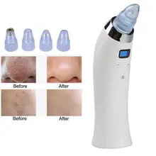 Электрический удаления угрей присоска черный 5 в 1A белая головка Прыщи 3 H пор 3 H очиститель для женщин