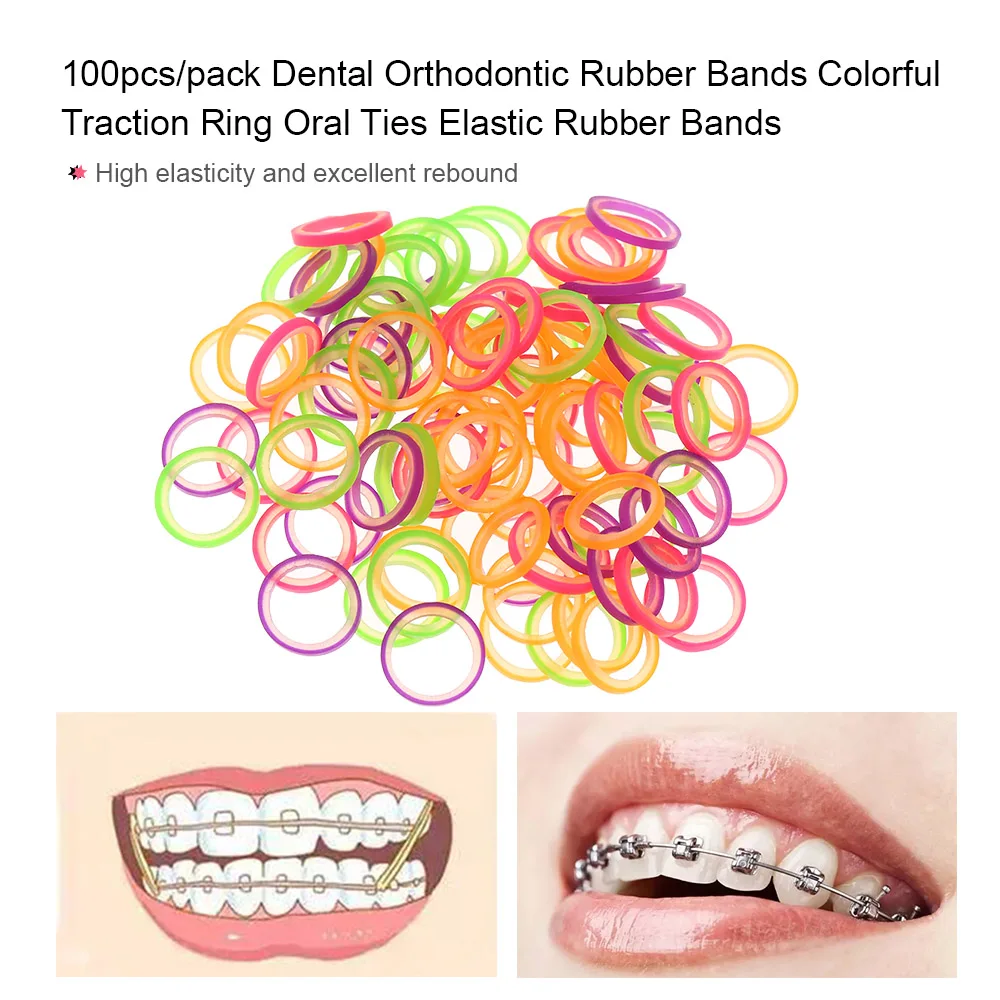 

100pcs/pack Dental Orthodontic Rubber Bands Colorful Traction Ring Oral Ties Elastic Rubber Bands Dentist Tools