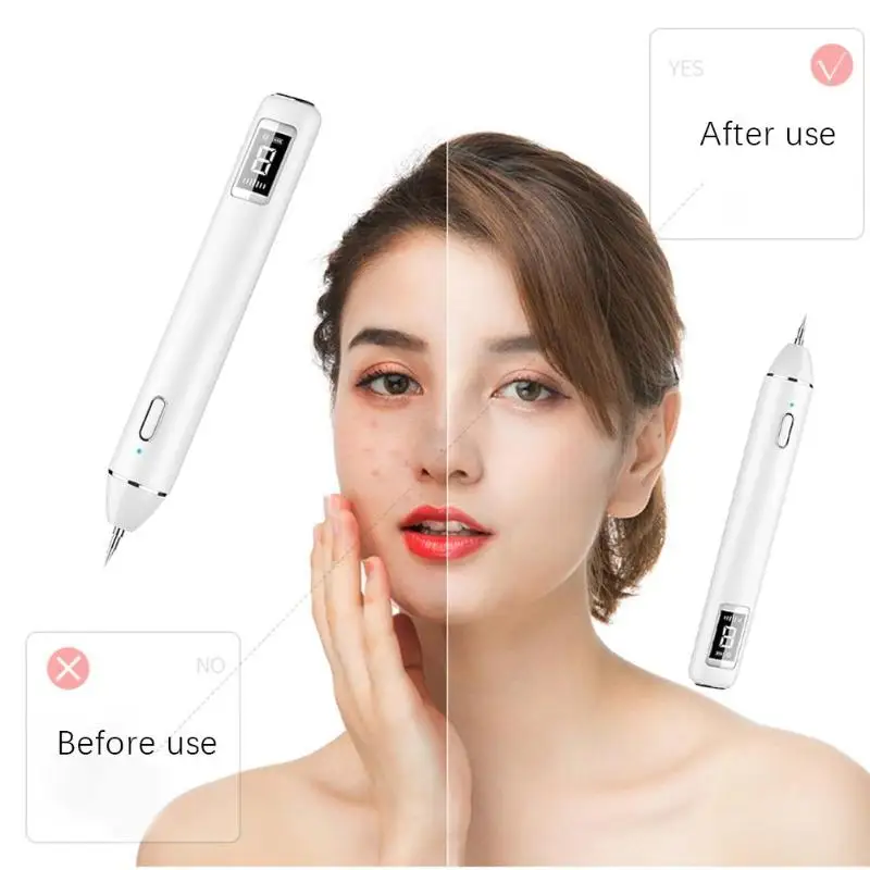 

facial cleaner tool LCD display screen Laser Plasma Pen Freckle Tattoo Removal Skin Care Cleaner