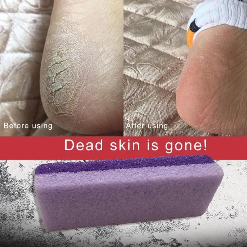 Buy 4pcs Pumice Stone Feet Hard Skin Callus Remover