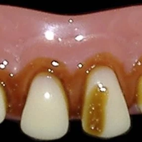 Faux Dents Cave Man W Cavite 1070 Dent Pourrie Teinte Costume Drole Nouveau Laid Aliexpress