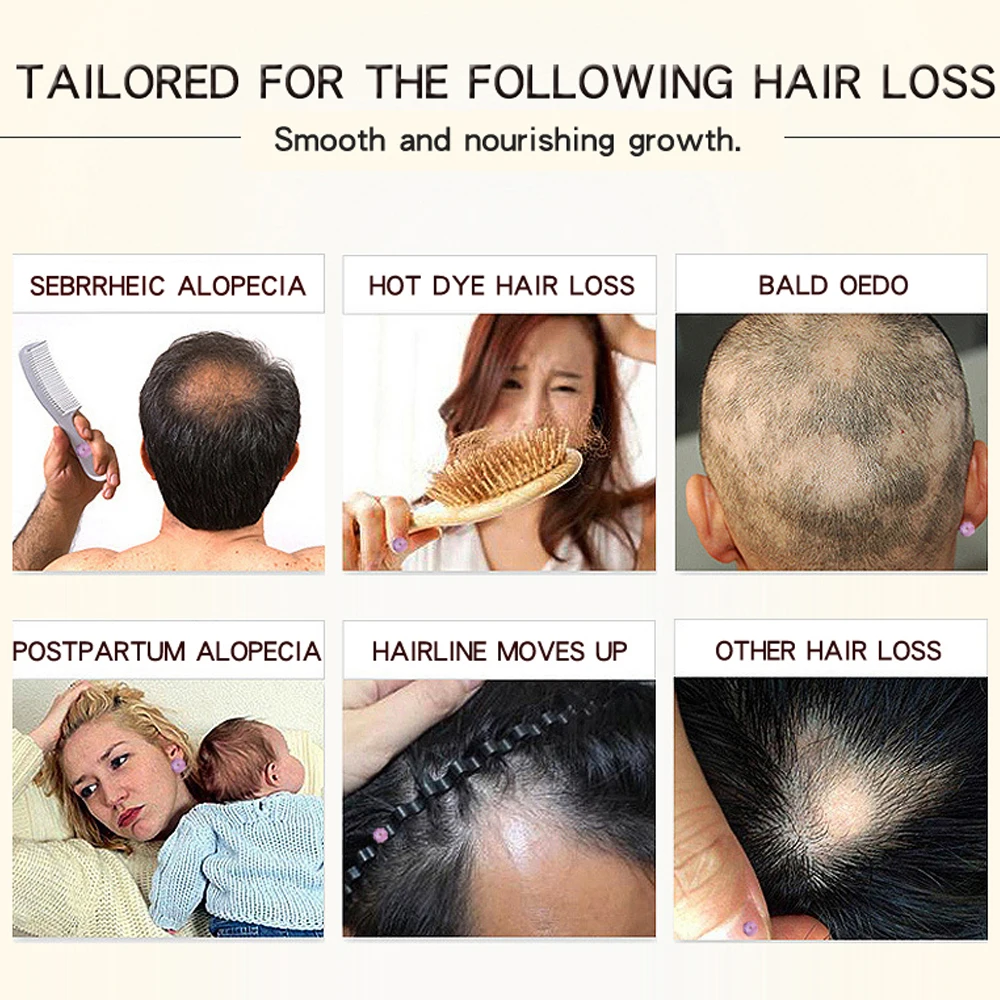 Morocco Herbal Ginseng Hair Care Essence Treatment For Men And Women Hair Loss Fast Powerful Hair Growth Serum Repair Hair root Morocco Herbal Ginseng Hair Care Essence Treatment For Men And Women Hair Loss Fast Powerful Hair Growth Serum Repair Hair root