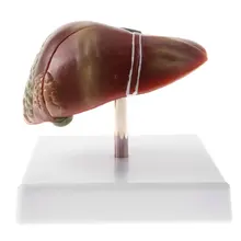 Human Liver Pathological Model with Base Medical Anatomical Model for School Teaching Tool Learning Display Lab Supplies