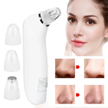 

Vacuum Suction Blackhead Removal Pore Cleaner Skin Peeling Machine 4 Suction Probes Blue LED light 4