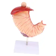 1.5X увеличение желудка патологическая модель человеческий орган анатомическая модель школьный учебный инструмент обучающий дисплей лабораторные принадлежности