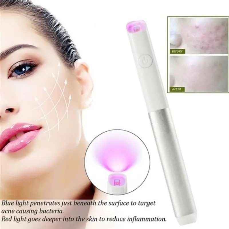 

Vein Anti-varicose Veins Removal Pen Light Machine for Anti-Inflammation Acne Scar Removal Wrinkle Removal Treatment Skin