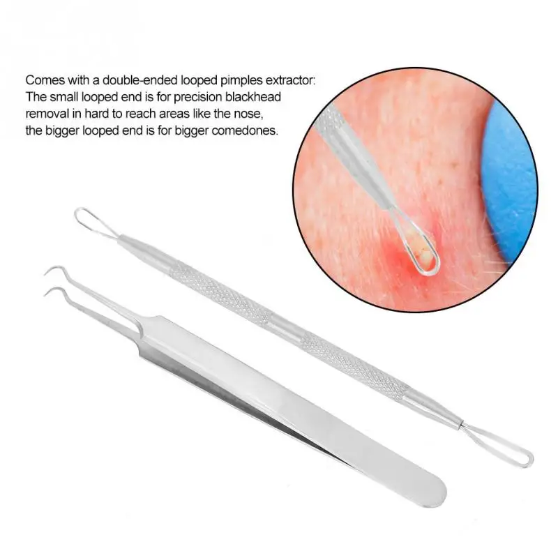 

Stainless Steel Blackhead Removal Tool Kit Curved Tweezers+Looped Double-end Pimple Extractor Acne Removal Needle Set