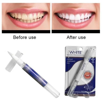 

Effective Teeth Whitening Pen Tooth Gel Whitener Teeth Whitening Pen Gel Tooth Cleaning Bleaching Kit Dental Whitening Teeth Pen