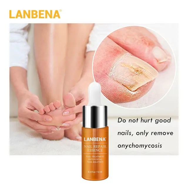 LANBENA Nail Repair Essence Serum Nail Treatment Remove Fungal  Onychomycosis Toe Brighten Nourishing Hand Foot Skin Care 12ml
