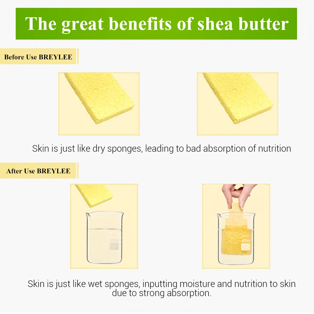 Breylee Face Cream Shea Butter Moisturizing Lotion Skin Care Anti Acne Treatment Facial Emulsion Easy To Absorb Day Night Cream