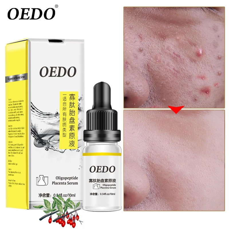 

OEDO Oligopeptide Placenta Serum Face Cream Acne Treatment Skin Care Repair Whitening Anti Anging Winkles Essence Moisturizing