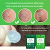 BREYLEE Acne Pimple Patch  Stickers Acne Treatment Pimple Remover Tool Blemish Spot Facial Mask Skin Care  Waterproof 22 Patches ► Photo 2/6