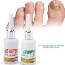 Лечение ногтей от грибка крем отбеливающий носок Уход за ногтями эссенция удаление грибка жидкий носок грибка для ногтей грибки лечение аксессуары