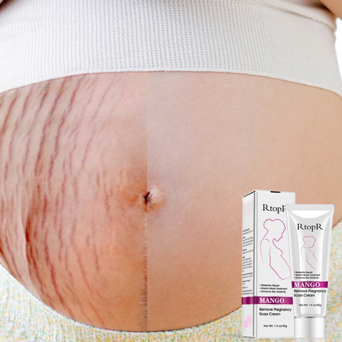 Крем от шрамов для беременных, восстанавливающий растяжки, крем для ухода за телом, крем против старения против морщин, укрепляющий крем