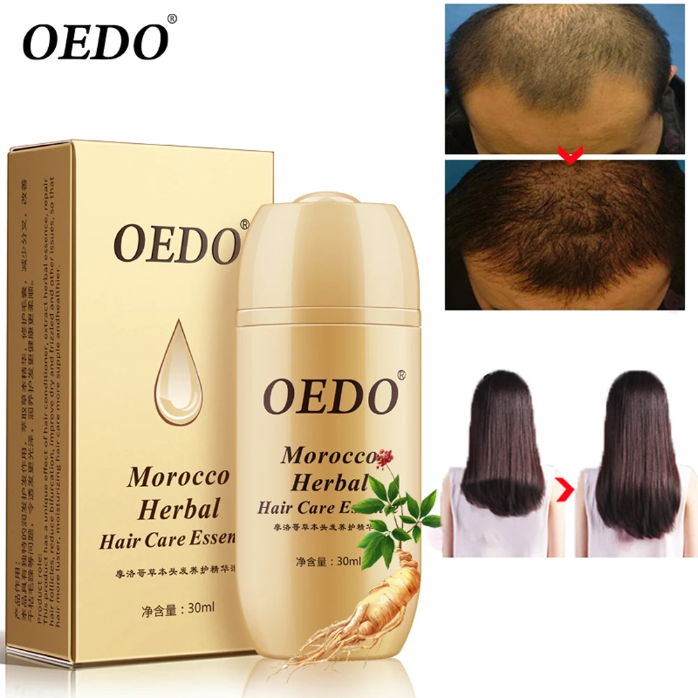 

OEDO Hair Loss Fast Powerful Hair Growth Serum Repair Hair Root Morocco Herbal Ginseng Hair Care Essence Treatment For Men Women