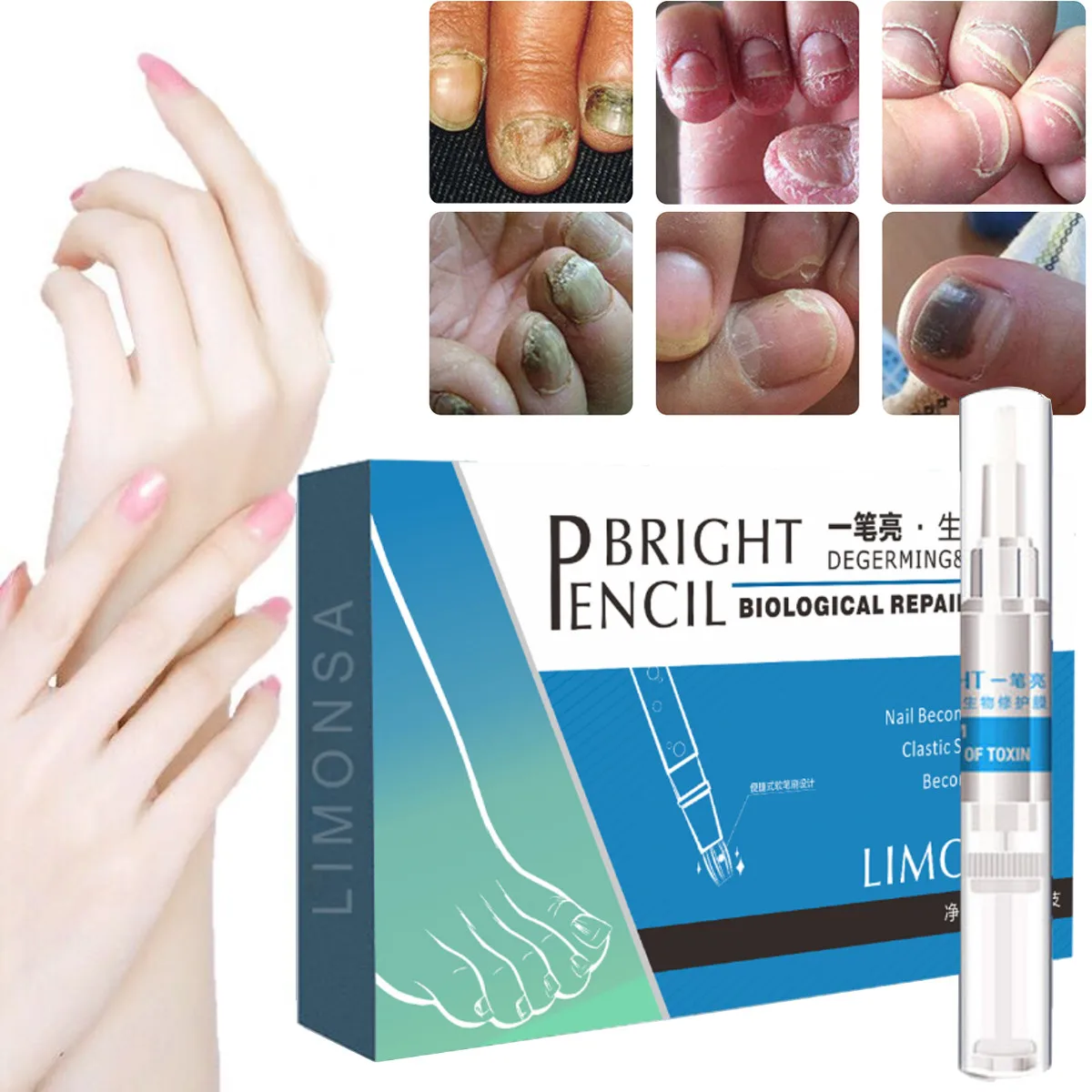 

4pcs Nail Fungal Treatment Pen Anti Fungus Infection Biological Repair Solution Nutritious Oil Restores Healthy Toenail 3ml