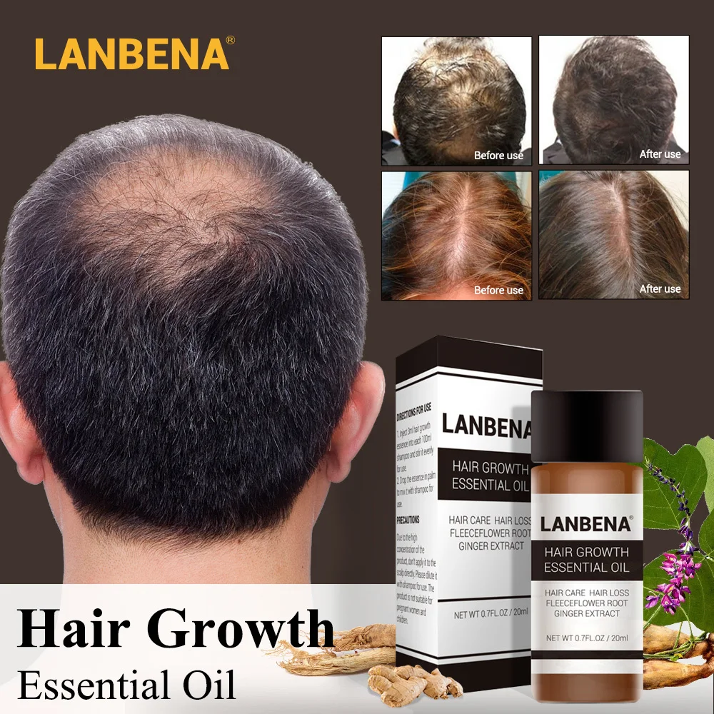 

Lanbena Fast Powerful Hair Growth Essence Products Essential Oil Liquid Treatment Preventing Hair Loss Hair Care Andrea 20ml