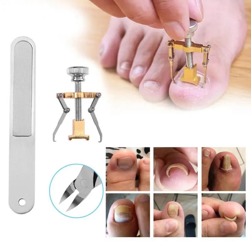 

3pcs Ingrown Toenails Manicure Pedicure set Foot Nail Care Ingrown Toenail Fixer Recover Correction Device Onyxis Bunion