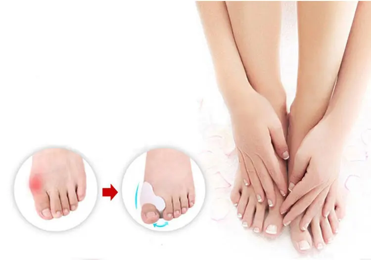 MATAVENI 1Pair Gel Foot Care Tool Bunion Corrector Bone Big Toe Protector Hallux Valgus Straightener Toe Spreader Pedicure