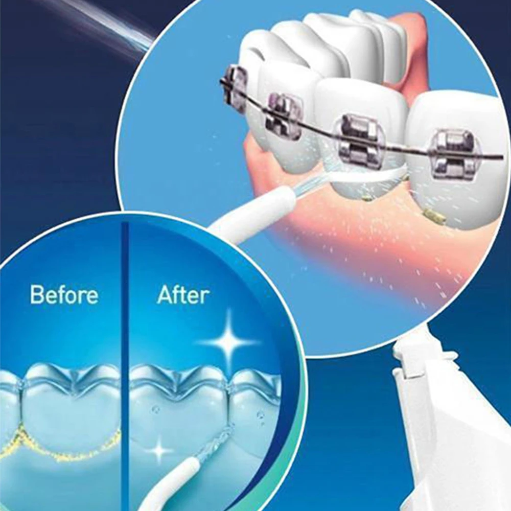 Зубная нить Мощность полости рта воды для чистки зубов струи Портативный уход за зубами оборудование
