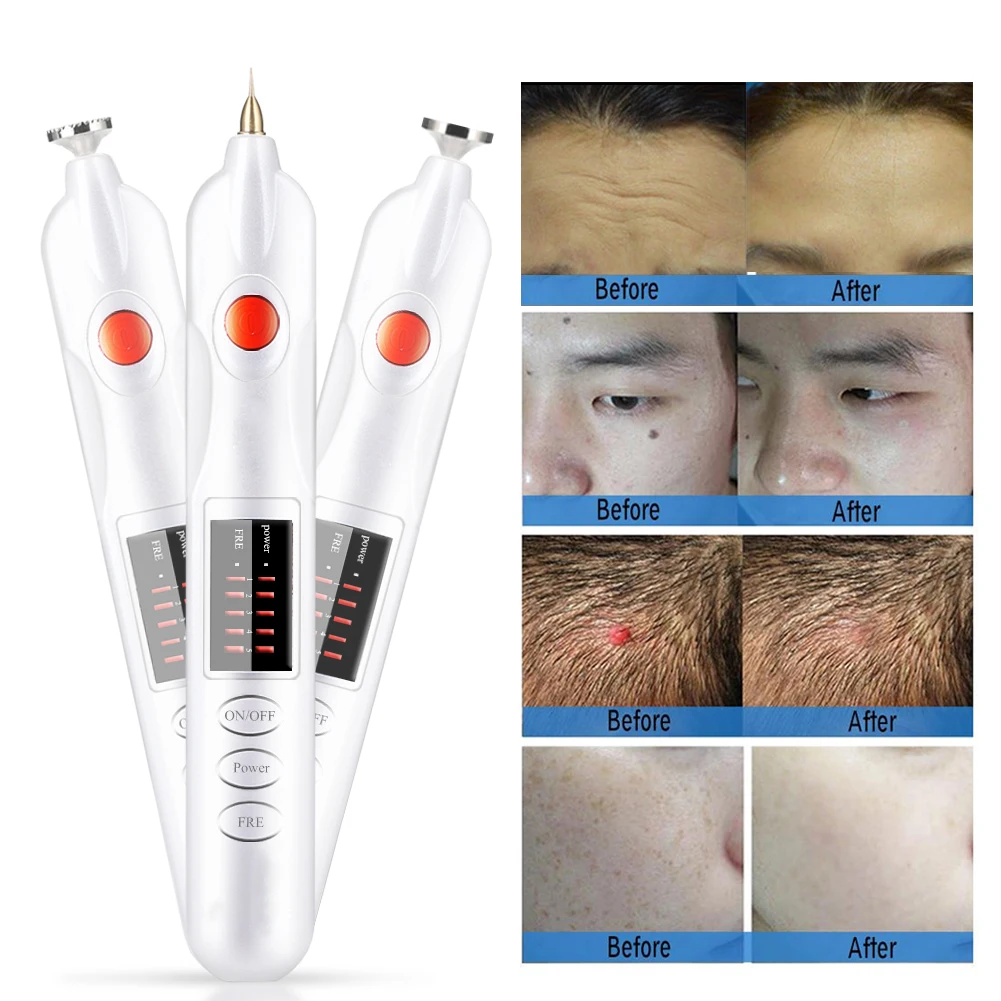 

Professional Freckle Wrinkle Mole Tattoo Removal Pen Powerful Plug-in Scar Tattoo Remove Machine Electric Magic Ionic Plasma Pen