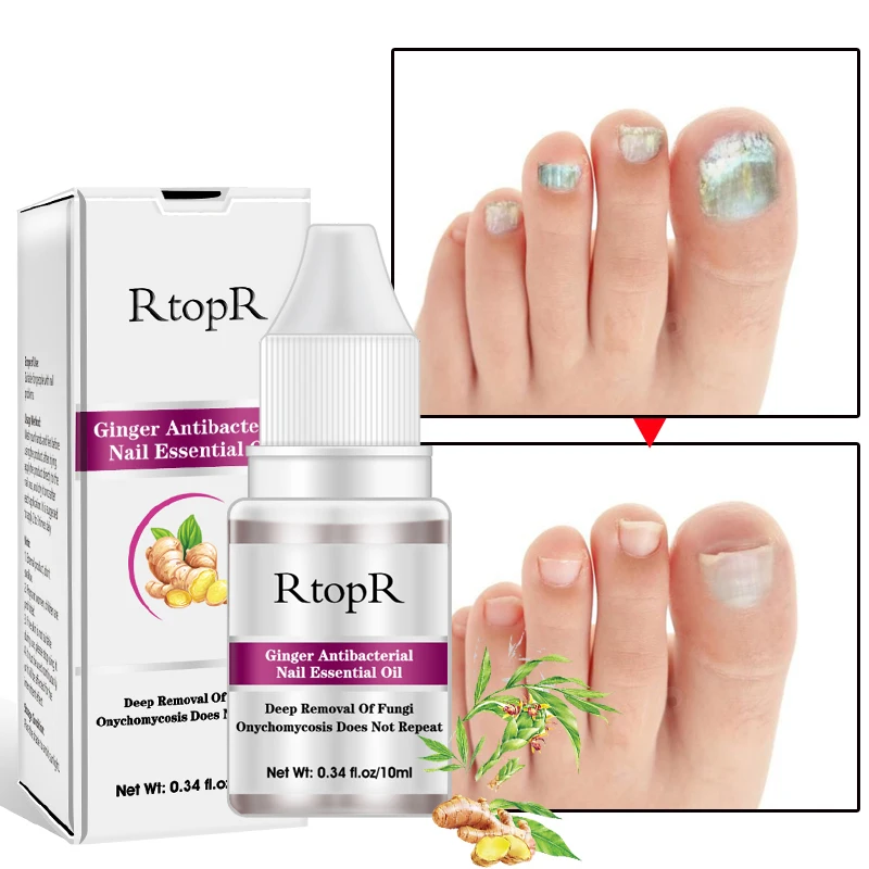 

Nail Treatment Essential Oil Toe Finger Nail Anti Fungus Nourishing Care Liquid