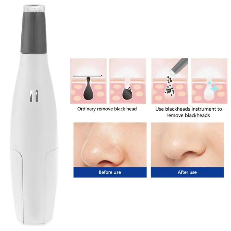 

Alloet Electric Blackhead Vacuum Cleaner Super Suction Blackhead Removal Scar Acne Pore Peeling Remover Facial Cleaning Device