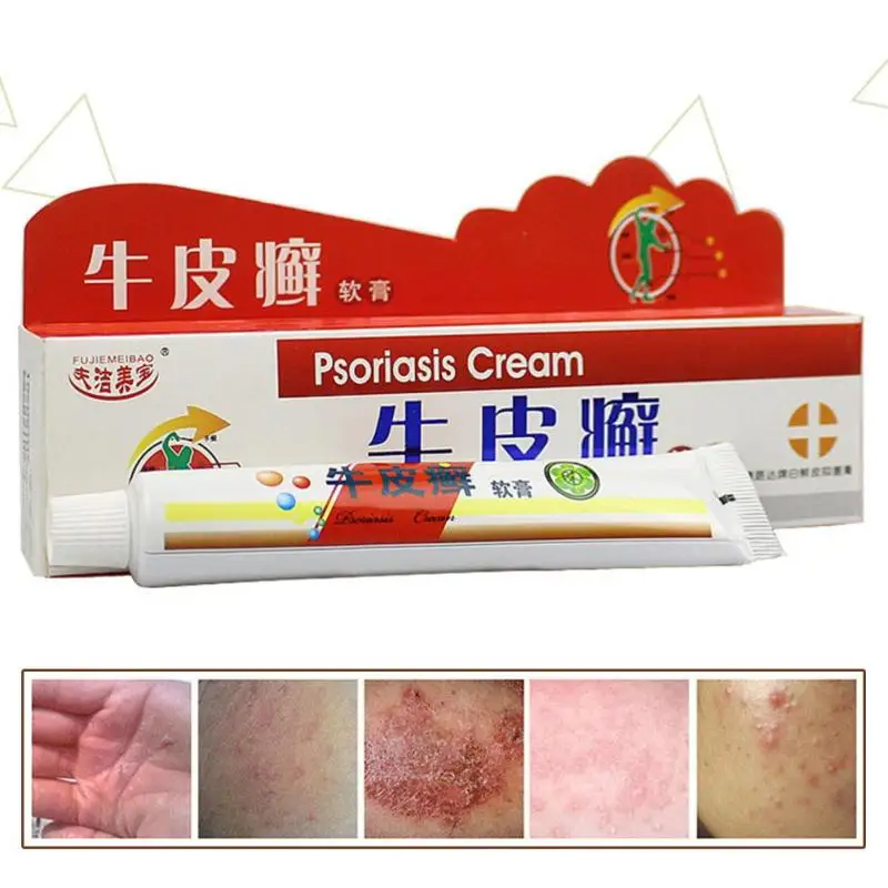 1pc Psoriasis Eczma Cream Works Perfect For All Kinds Of Skin Problems Patch Body Massage Ointment Chinese Medicine U3 | Красота и