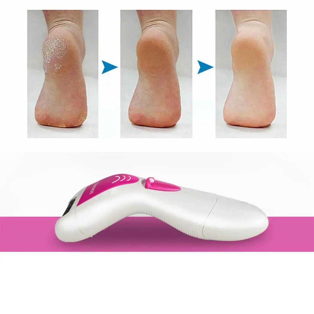Прочный Электрический Foot Repair машины шлифовальные стопы USB Отшелушивающий