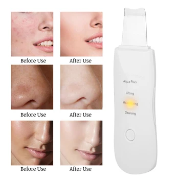 

Ultrasonic Vibration Skin Scrubber Ions Deep Cleansing Spatula Blackhead Grease Removal USB Charging d