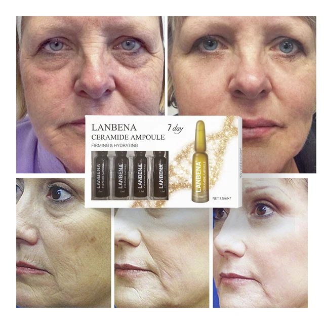 LANBENA Ceramide Ampoule Serum Nourishing Firming Hydrating Shrink Pores Anti-aging Lifting  Anti-wrinkle For 7 Days Skin Care