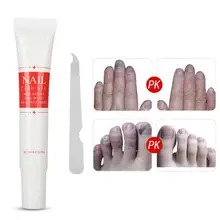 Гель для ремонта ногтей Лечение ногтей от грибка Onychomycosis Питательный гель для ухода за ногтями с мелкими пилками противогрибковые носочки для ногтей