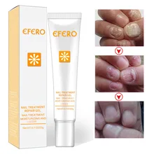 Восстанавливающая эссенция масло для удаления кутикулы ногтей усилитель антисептик крем противогрибковый Маникюр мазь инструменты для ухода
