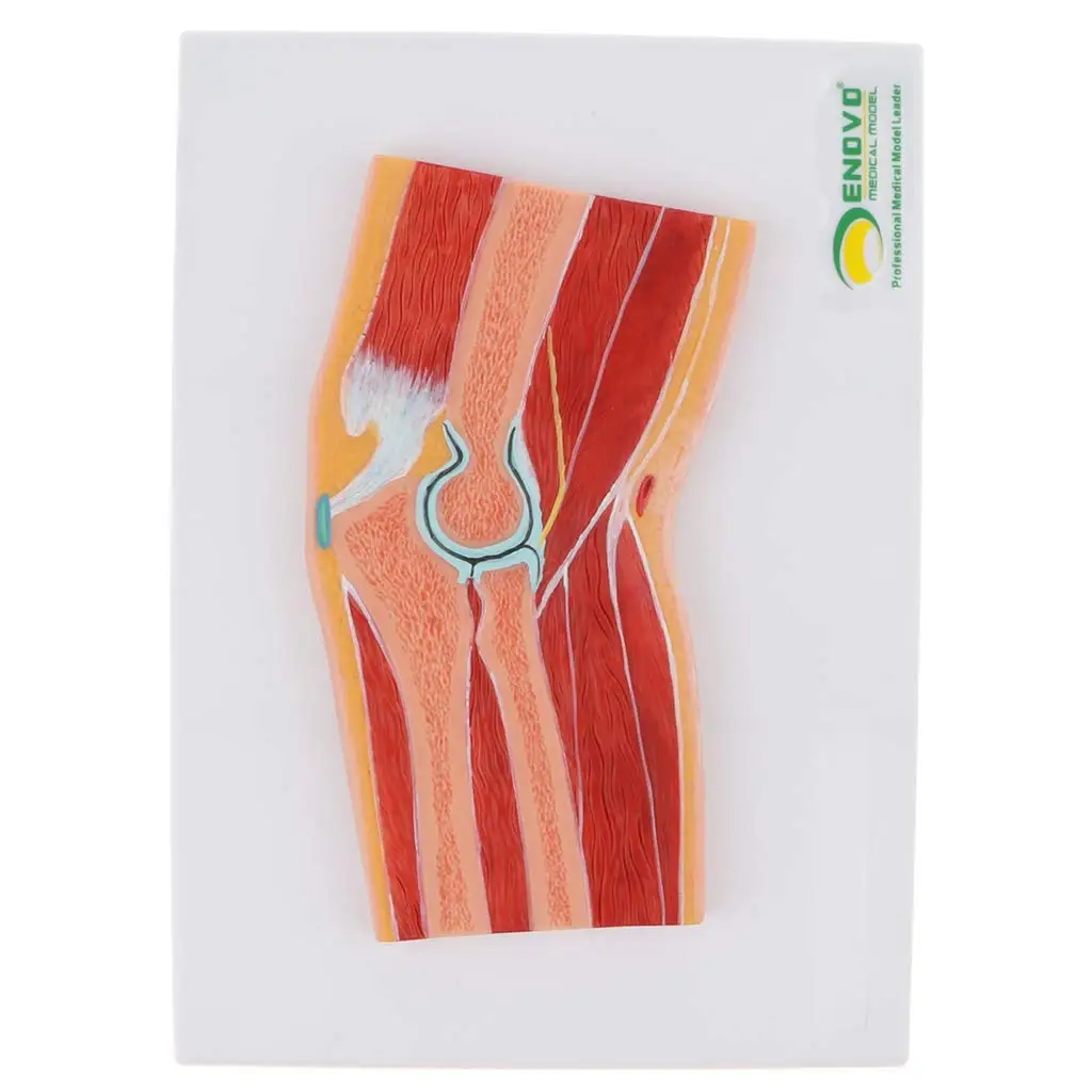 

1: 1 Articular Elbow Joint Muscle Skeleton Model Human Anatomical Model for School Teaching Tool Learning Display Lab Supplies