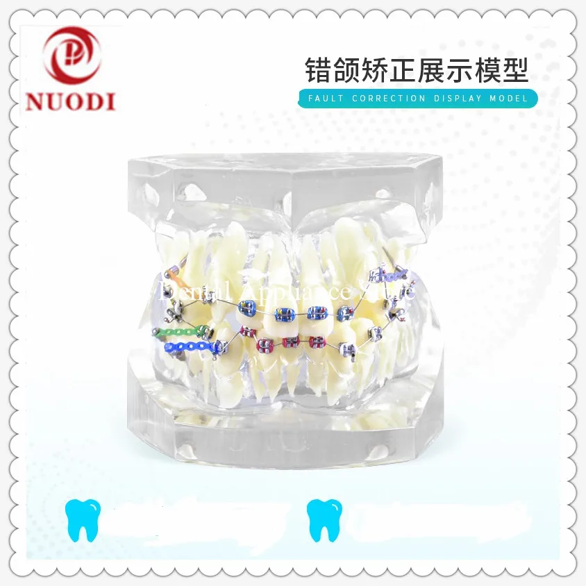 

Fault Correction display Orthodontic Teeth Model/Dental Orthodontic Teeth Model M3005 with bracket
