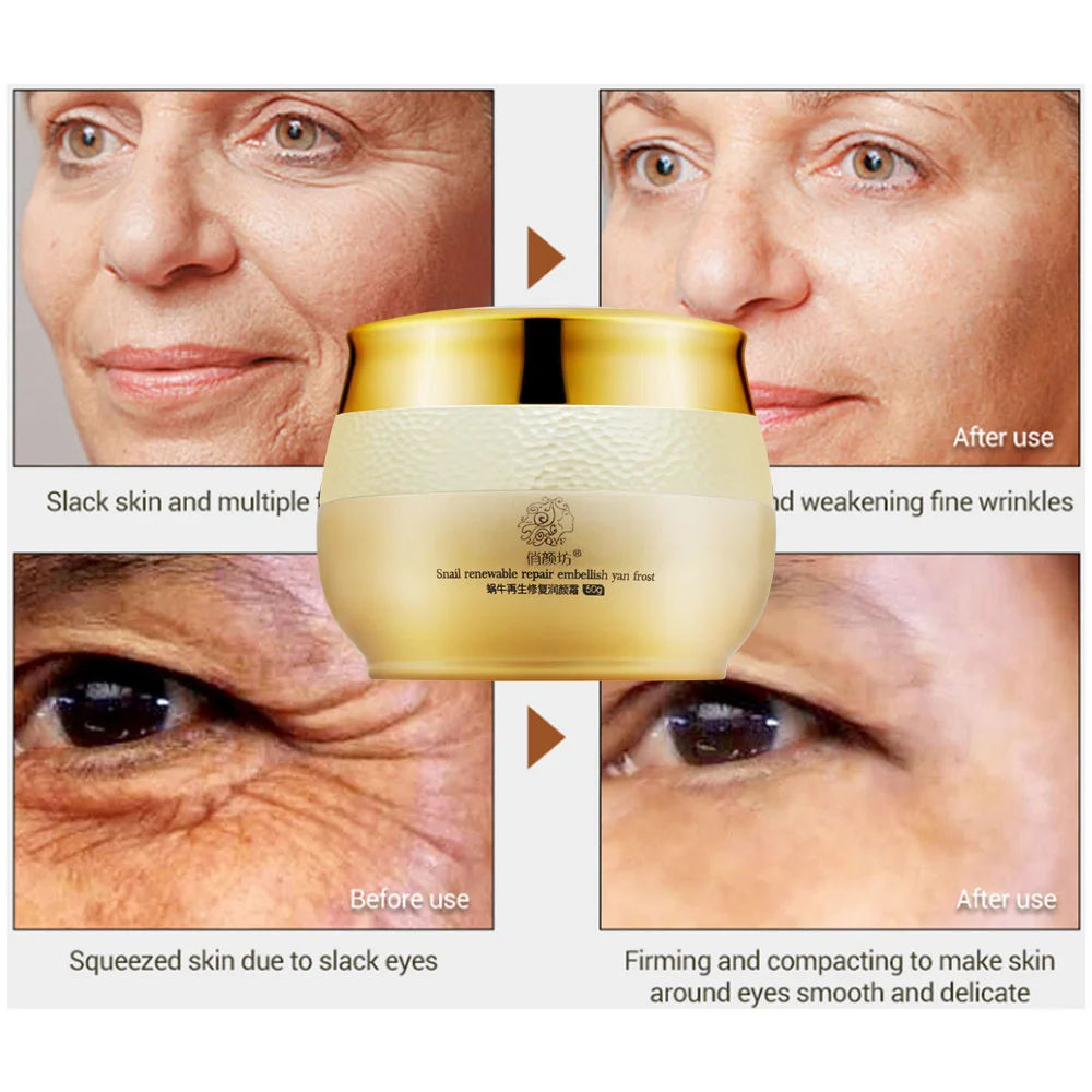 

QYF Whitening Snail Cream Treatment Acne Pimples Reduce Scars Moisturizing Anti Wrinkle Face Lift Firming Face Skin Care Cream