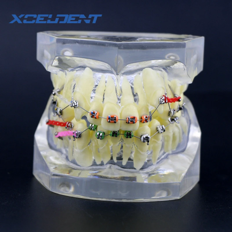 

1Pcs Orthodontic Dental Treatment Malocclusion Model W/ Brackets Chain Wire #3005-3 Dental Laboratory Dental Teeth Models