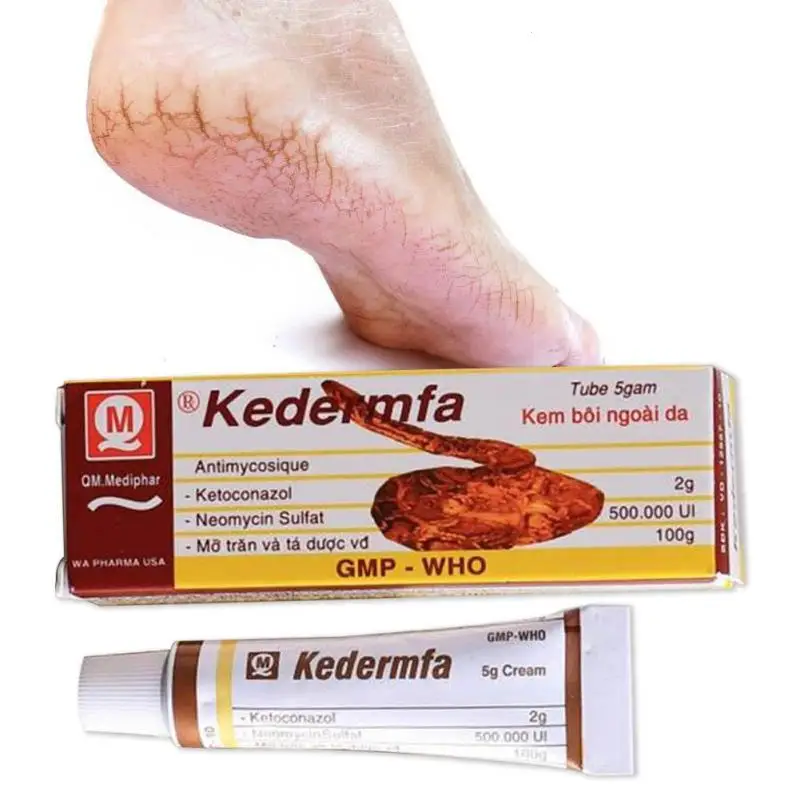 

100% Natural Original Snake Oil itching cream Remove Scar cream Striae Pigmentation Corrector Ointment Soothe Itch L3