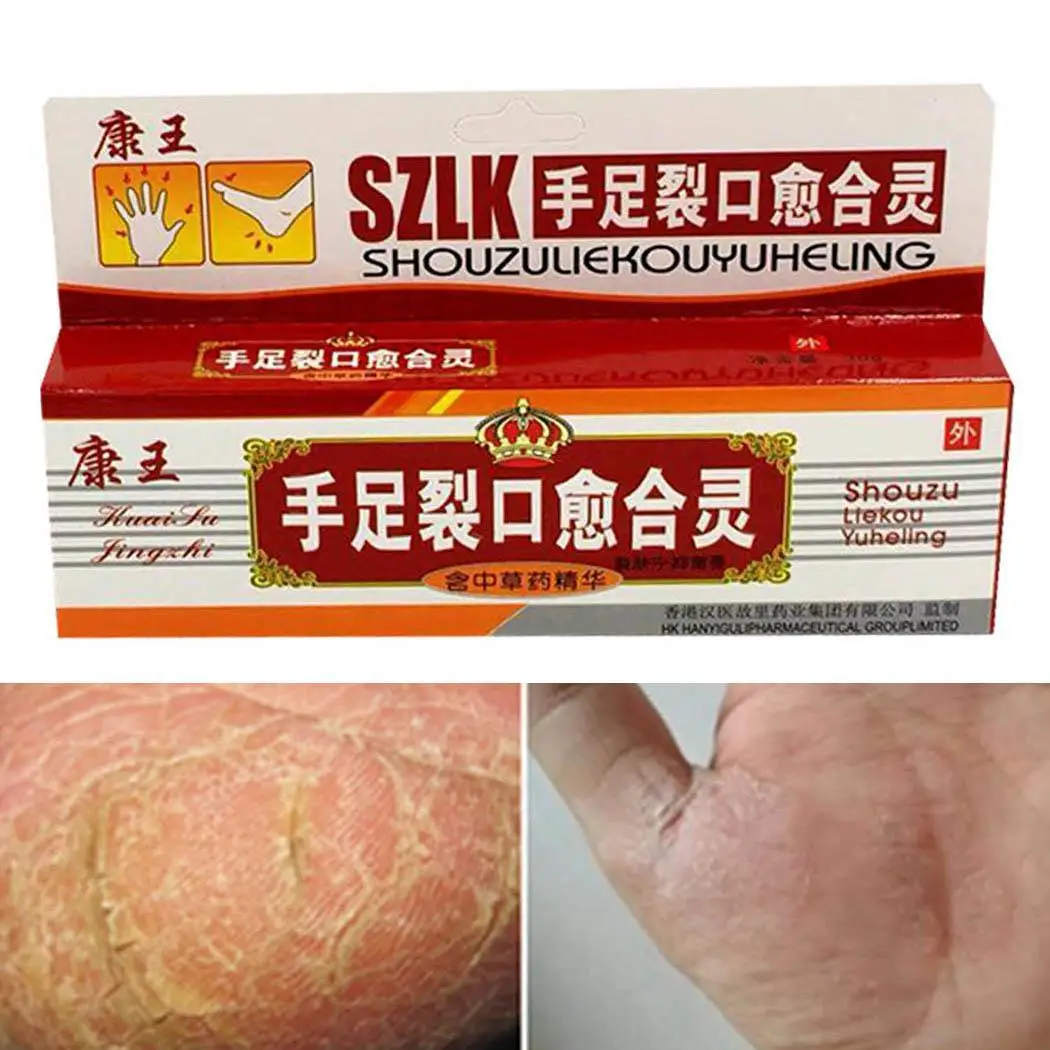 

30g Unisex Chapped Hands Repair Medicine Use Chinese External White New Foot Cream medicine Herbal herbal Manual