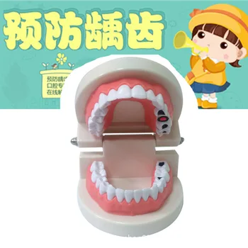 

ABS PVC Dental Model Oral Instrument Tools Dental Consumables Tooth Decay Model Medical Care Teaching Aids Teeth Model