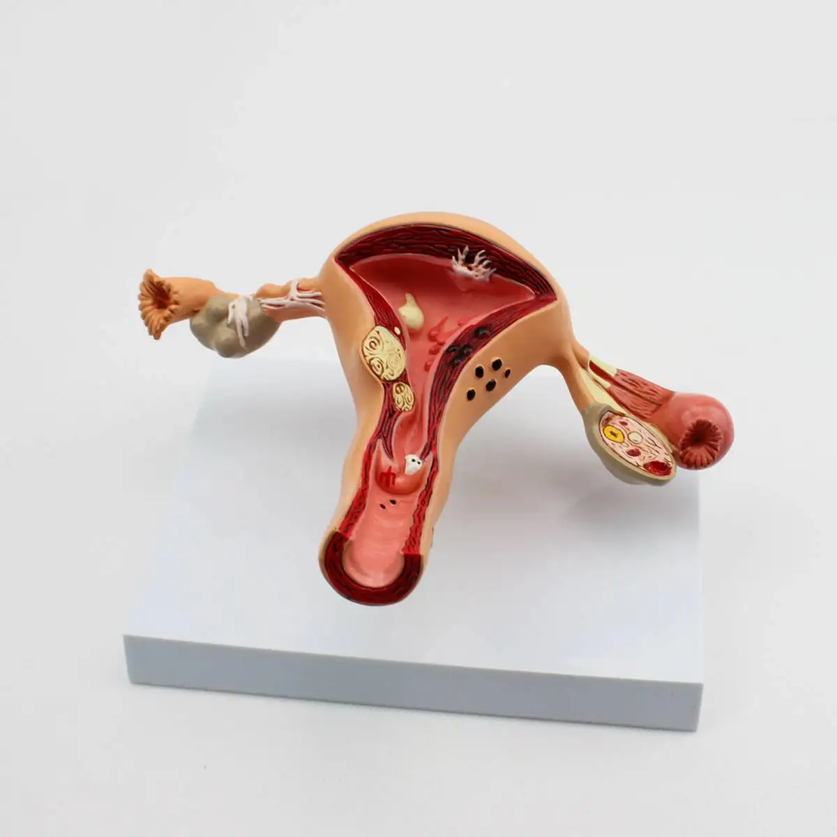 

Uterus Ovary Anatomical Model Anatomy Cross-Section Uterine Disease Life Size Medical Science Teaching Model Educational Props