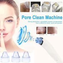 Алмазная дермабразия угрей пылесос всасывание удаление шрамов акне пилинг для пор лица чистый уход за кожей лица красота машина