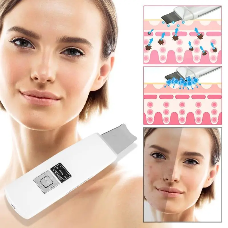 

LCD Ultrasonic Face Skin Cleaner Scrubber Dead Skin Remover Blackhead Wrinkles Spots Removal Deep Face Cleaning Machine EU/USB