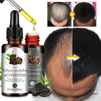 

2pcs/set Hair Growth essential oils Professional Hair Growth Fluid Hair Fast Sunburst Hair Growth Product Anti-de-solidification