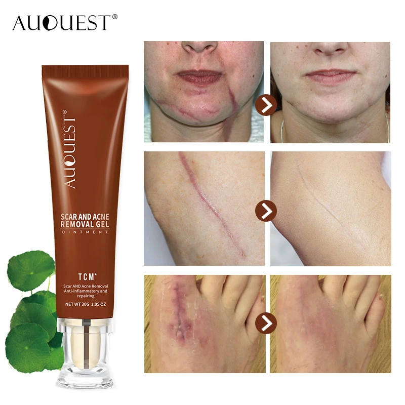 AUQUEST Face Cream Ginseng Extract Remove Acne Scars Repair Gel Red Spots Moisturizing Cream Stretch Marks Whitening Skin Care