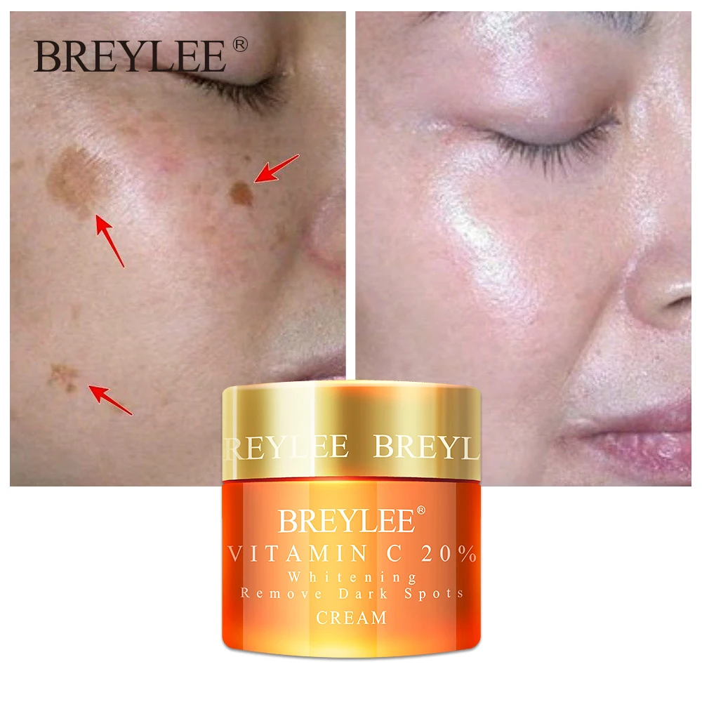Крем для лица BREYLEE с витамином С отбеливающий крем 20% веснушек удаления темных
