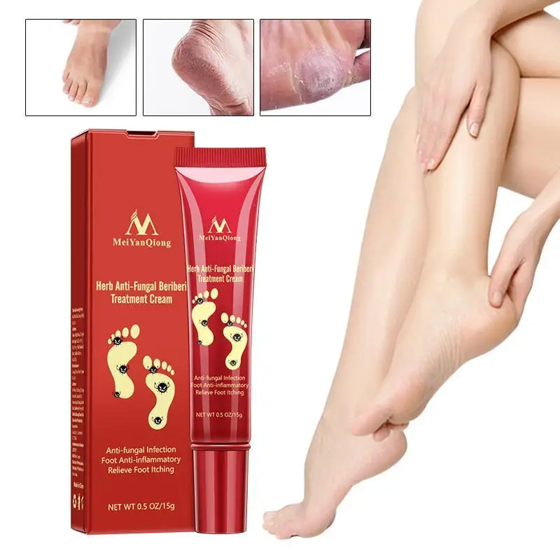 Anti Fungal Infection Foot Repair Cream Foot Cream Herbal Anti Fungal