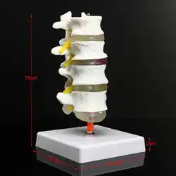 Новый 4 часть хиропрактики человека анатомическая модель поясничного позвонка позвоночника анатомическая модель преподавания ресурсов