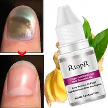 XY Fancy Onychomycosis Paronychia противогрибковые инфекция ногтей носок Лечение грибка эфирное масло восстанавливающая жидкость